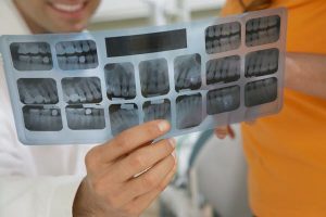 Services of a General Dentist in SJ, Utah
